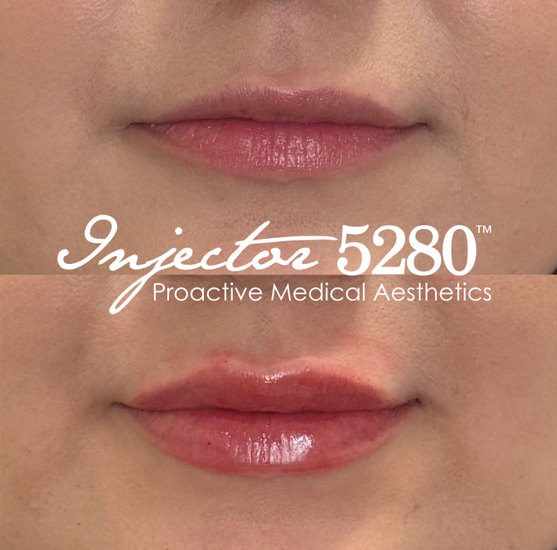 Denver 5280 Med Spa - Day Spa in Denver