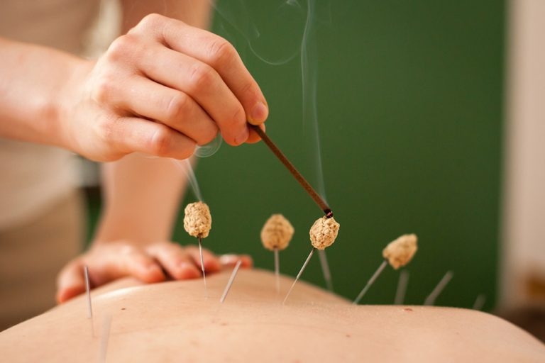 Acupuncture Clinic Re-Free Bel Air - Day Spa in Bel Air