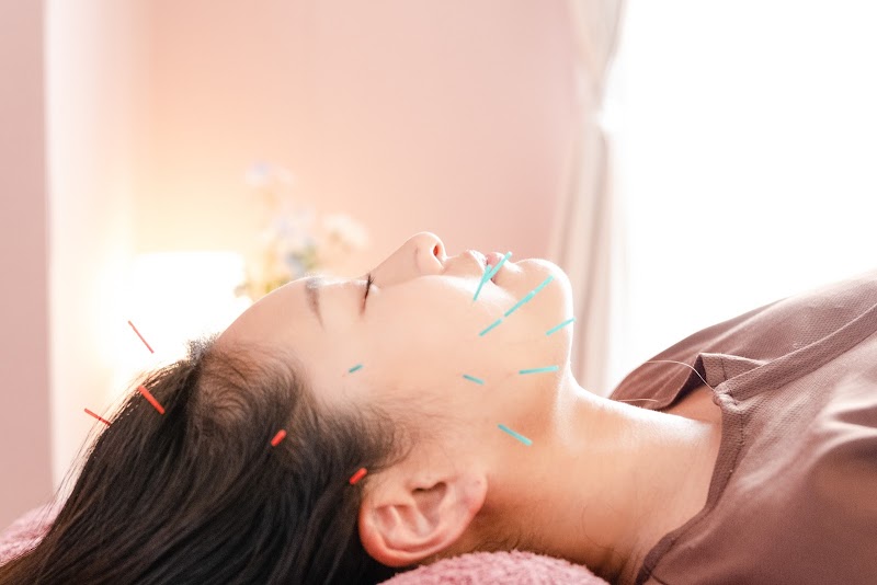 Acupuncture Salon hikari Kita Ward, Nagoya - Day Spa in Kita Ward, Nagoya