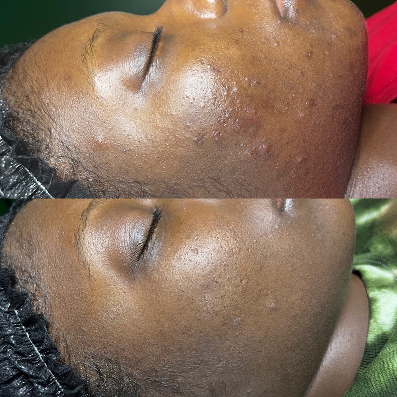 Aesthetics and Massage by Nichole Greenville - Day Spa in Greenville