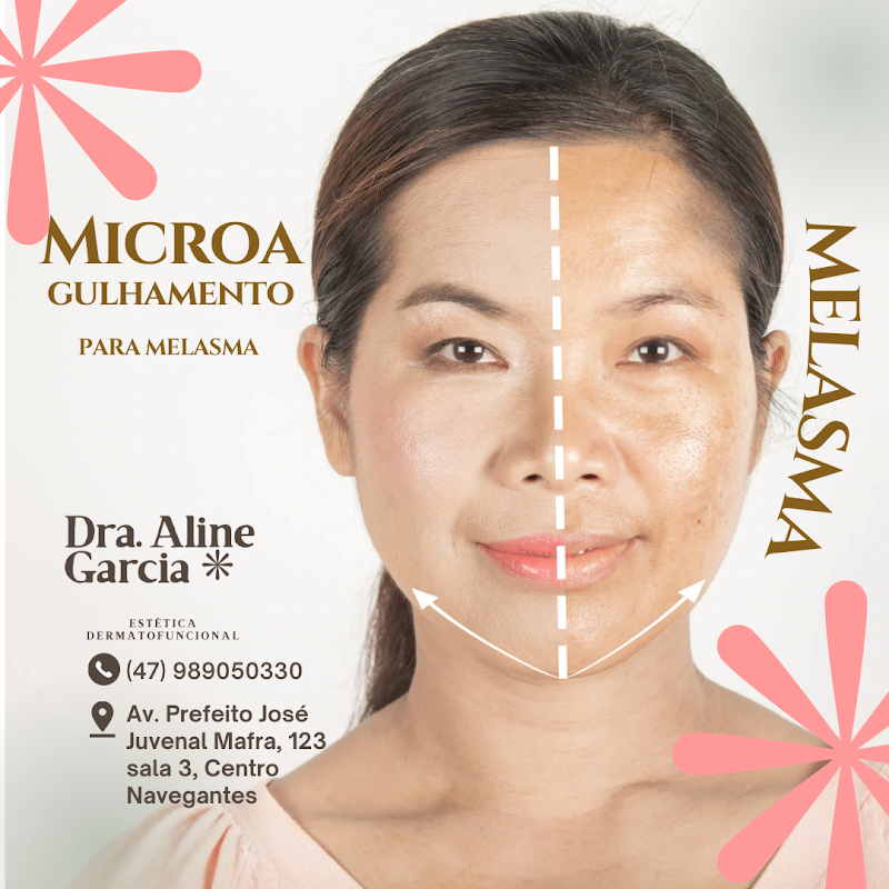 Aline Estética Marcelino Ramos - Day Spa in Marcelino Ramos