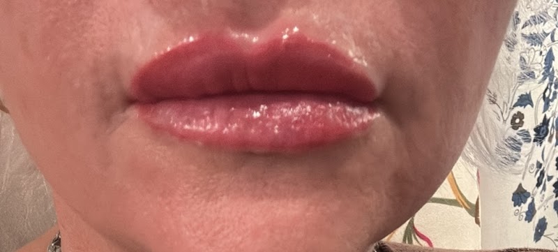 Aura Skin & Wellness Center Cape Girardeau - Wellness Retreat in Cape Girardeau