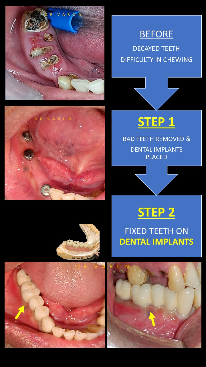 Bandhu Dental Clinic Delhi