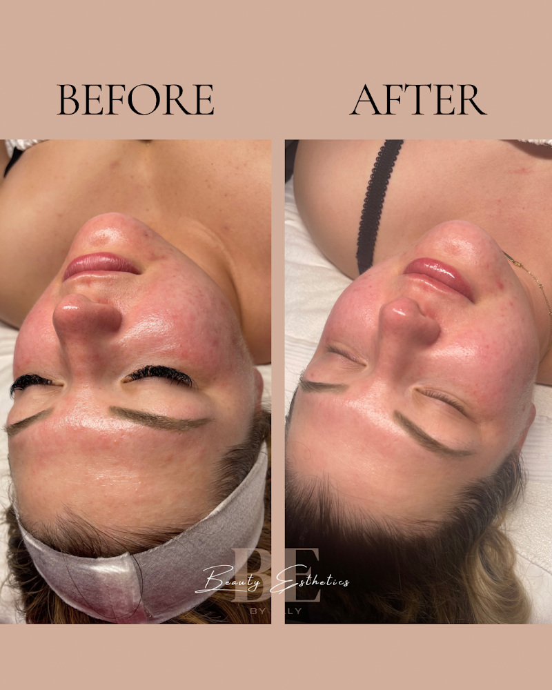 Beauty Esthetics by Ally Victorville - Day Spa in Victorville