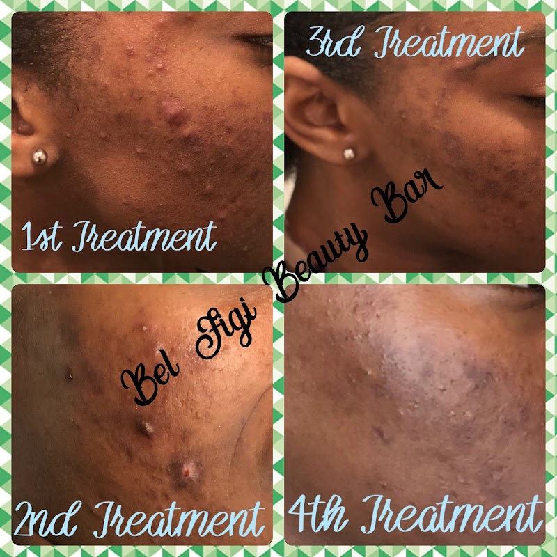 Bel Figi Inc Miami Gardens - Day Spa in Miami Gardens