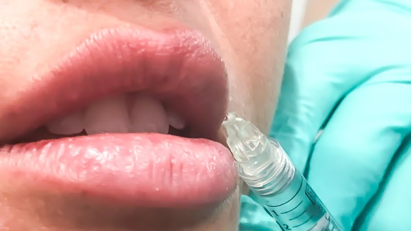 Bella Luce Medispa Huntington Beach - Day Spa in Huntington Beach