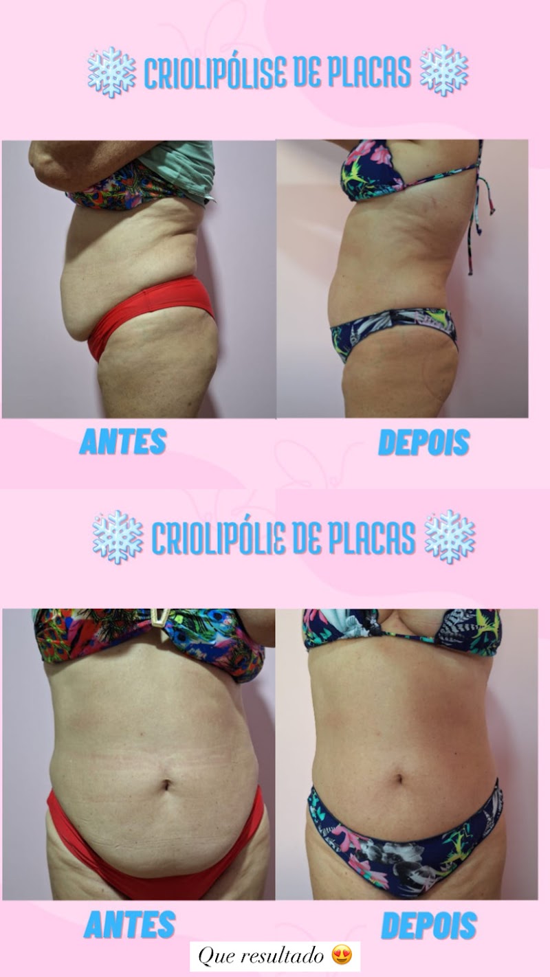 Bem Bella | Beauty Clínic Perdões - Wellness Retreat in Perdões