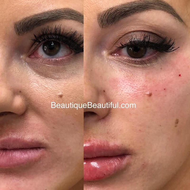 Bénévole Med Spa Knoxville - Day Spa in Knoxville