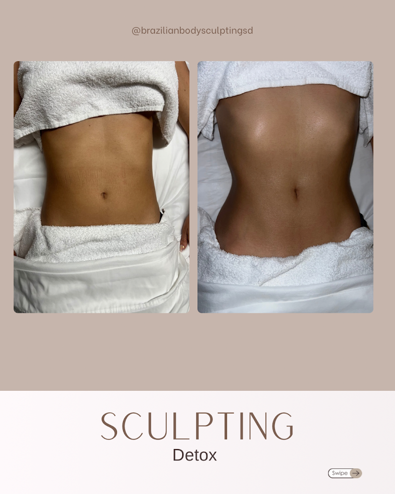 Body Sculpting and Massage by Daniel Lemon Grove - Day Spa in Lemon Grove