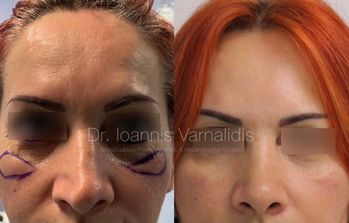 BodySculpture Dr. Varnalidis Thessaloniki - Day Spa in Thessaloniki