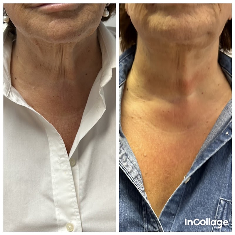 Bravo Shape STL St Louis - Wellness Retreat in St Louis