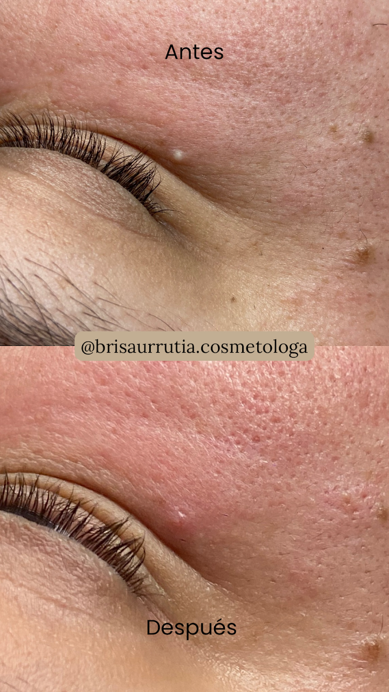 Brisa Urrutia Clínica Spa Gómez Palacio - Wellness Retreat in Gómez Palacio