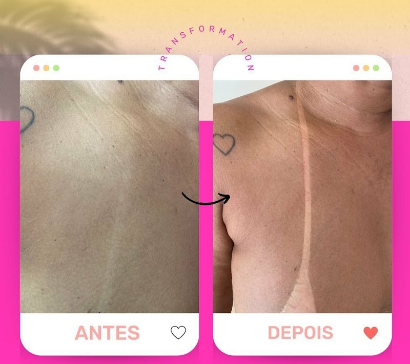 Bronze Alto Bronze Goiânia - Day Spa in Goiânia