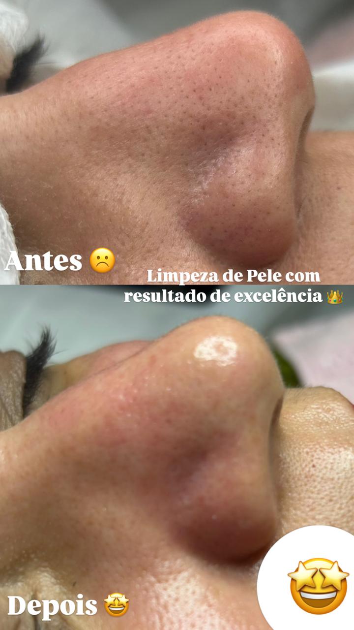 Centro de Estética Elane Resplandes Palmas - Day Spa in Palmas