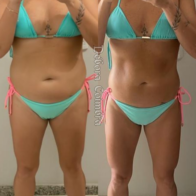 Centro Estético Débora Coimbra Nova Venécia - Wellness Retreat in Nova Venécia