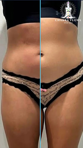 Chakra Spa Christ Church - Hotel Spa in Christ Church