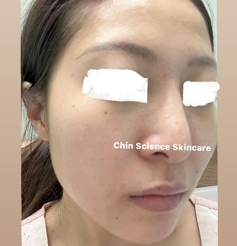 Chin Science Skincare Beauty Quận Gò Vấp - Day Spa in Quận Gò Vấp