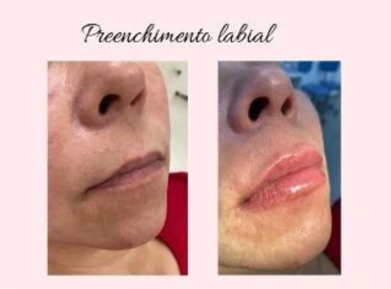 Chirlei Limas Estética Avançada Joinville - Wellness Retreat in Joinville