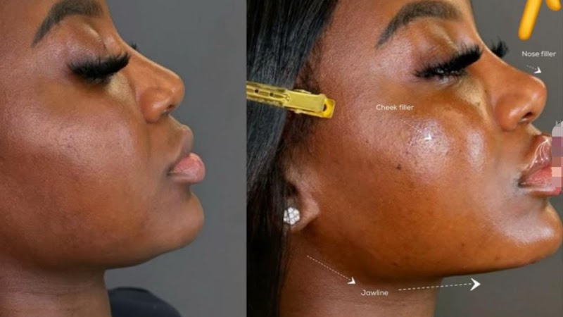 Cityb Aesthetic clinic Port Harcourt - Medical Spa in Port Harcourt