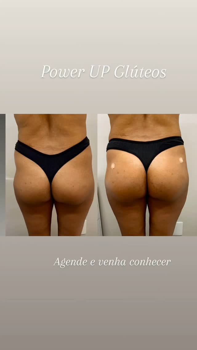 Clinica de Estetica Anaiza Casagrande Itumbiara - Medical Spa in Itumbiara