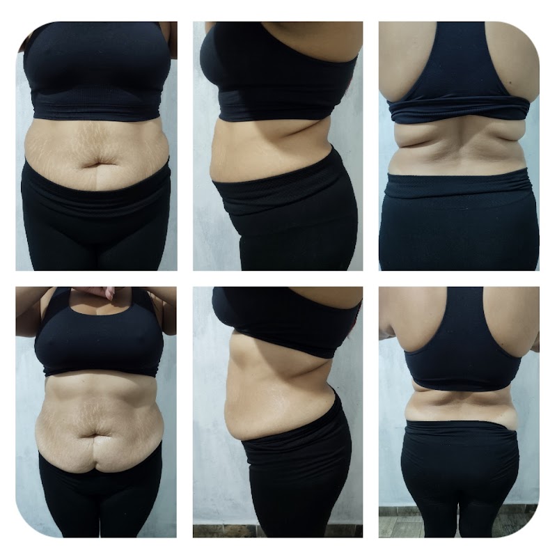 Clinica & Spa Cerefi San Juan del Río - Medical Spa in San Juan del Río