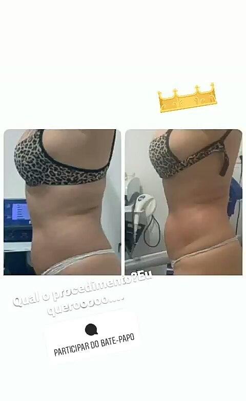 Clínica Vision Estetic João Pessoa - Wellness Retreat in João Pessoa