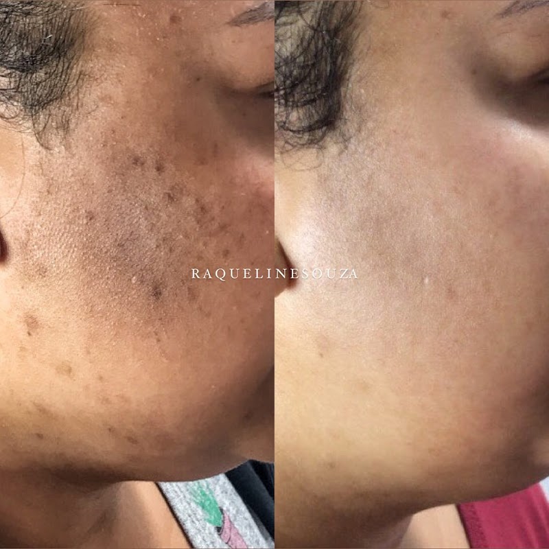 Consultório estético Raqueline Souza Louveira - Day Spa in Louveira
