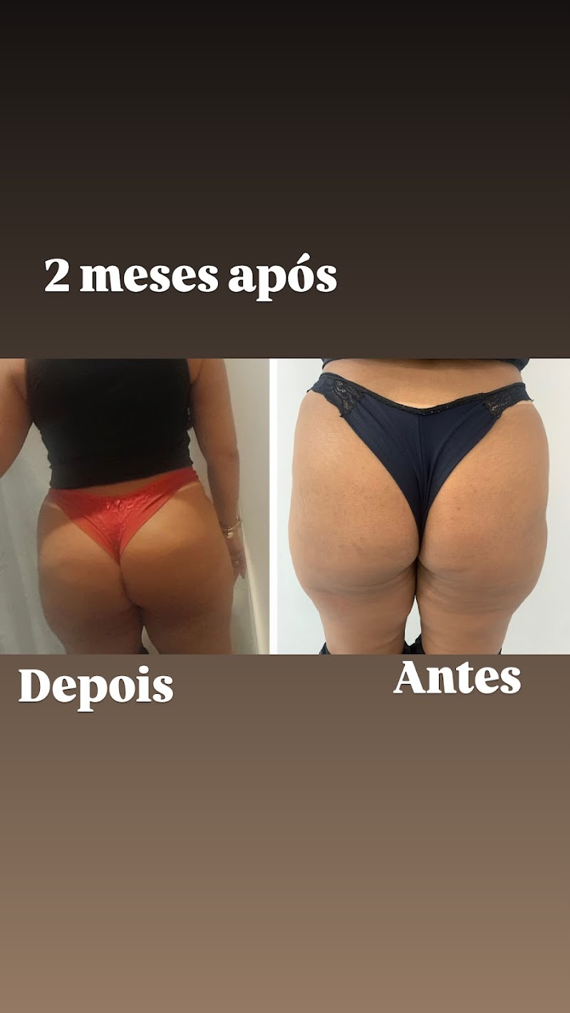 Cristiane Fonseca esteticista Leopoldina - Day Spa in Leopoldina