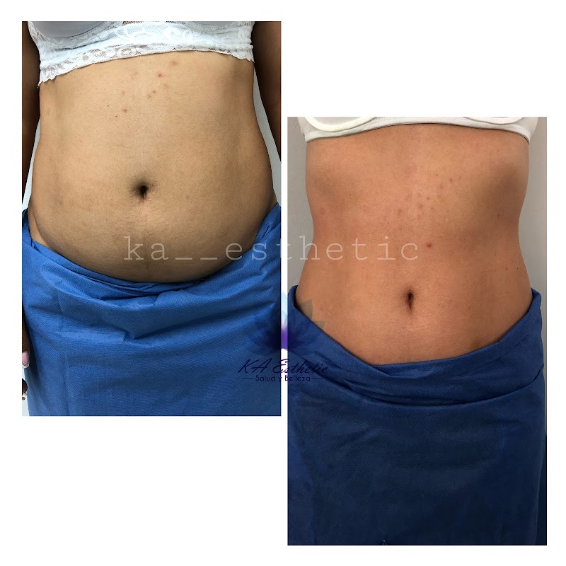 Cultura Estetica SPA Bello - Day Spa in Bello