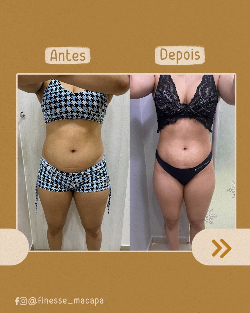 Defyne Fisioterapia Estética Macapá - Day Spa in Macapá