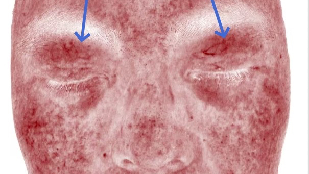 DermaQuip Marietta - Day Spa in Marietta