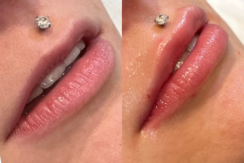 DERMÉ Med Spa Loveland - Day Spa in Loveland