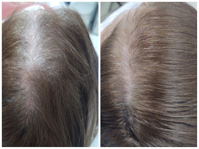 Dra Flávia Danielly Estética Avançada Guarulhos - Wellness Retreat in Guarulhos