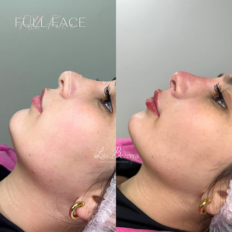 Dra Lais Bezerra Osasco - Day Spa in Osasco