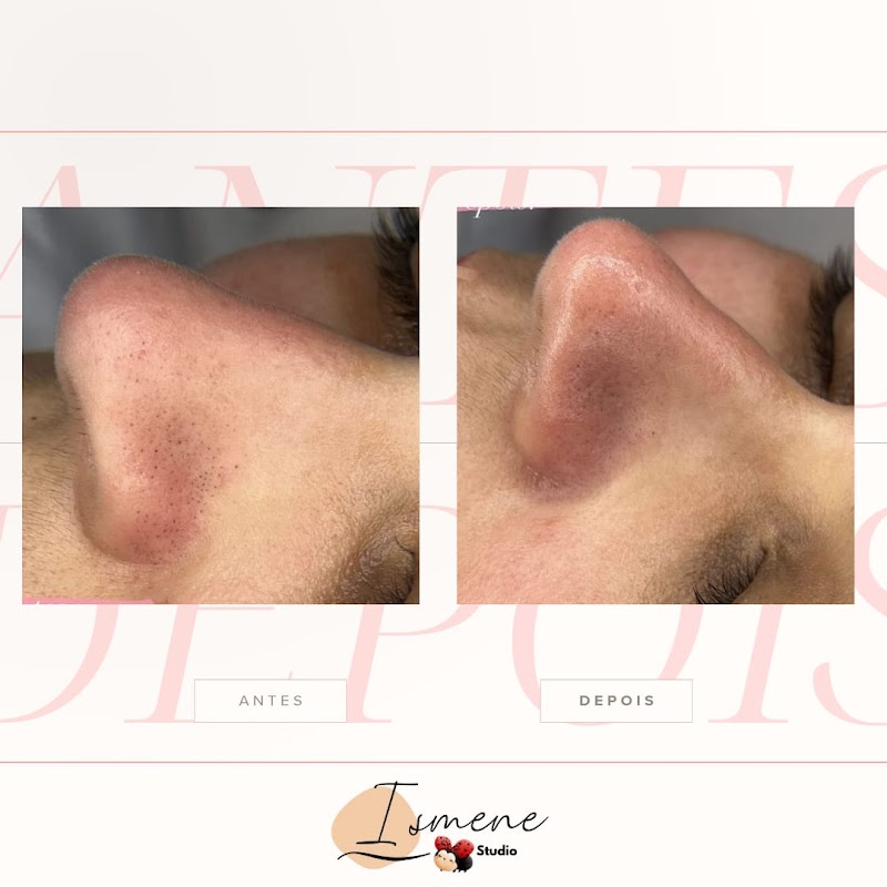 EE estética e pilates Osasco - Wellness Retreat in Osasco