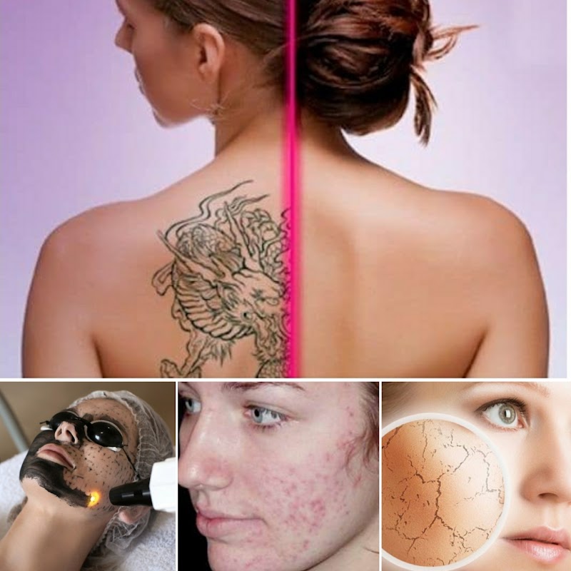 Elaine Benaglia Estética Clínica Avançada - Itápolis - SP - Day Spa in Itápolis