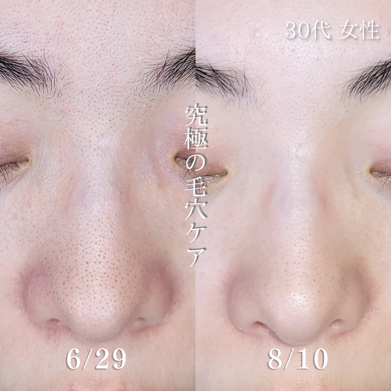 Kobe City Chuo Ward era: kayla - Holistic Beauty Salon. - Day Spa in Kobe City Chuo Ward