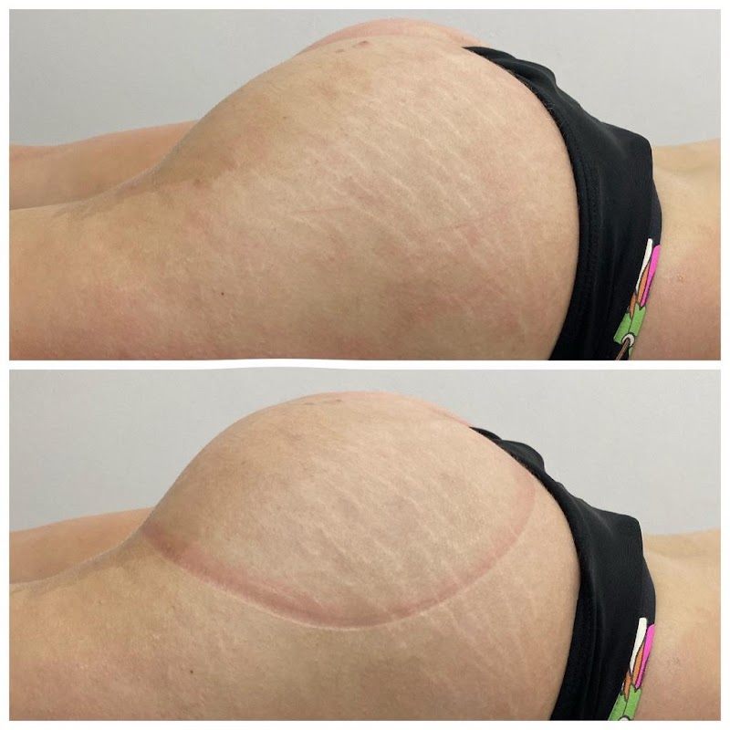 Espaço Estética Tatiane Schumacker Nova Friburgo - Day Spa in Nova Friburgo