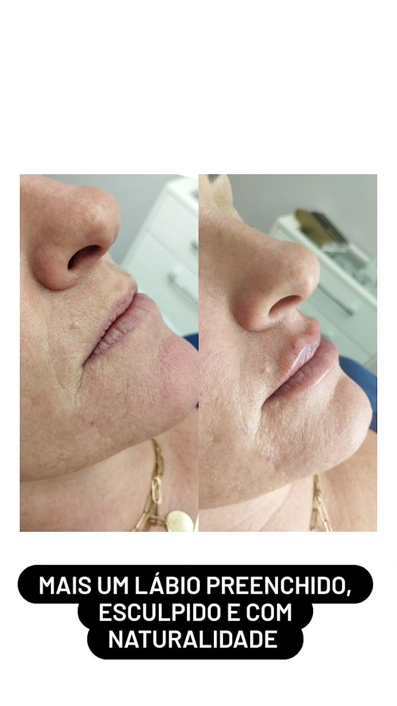Estética Bem Cuidar Três Coroas - Day Spa in Três Coroas