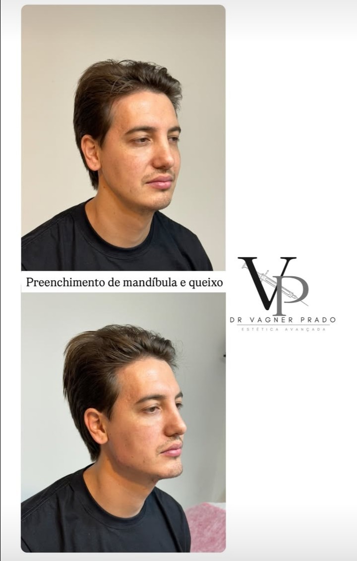 Estética Vagner Prado Itapema - Day Spa in Itapema