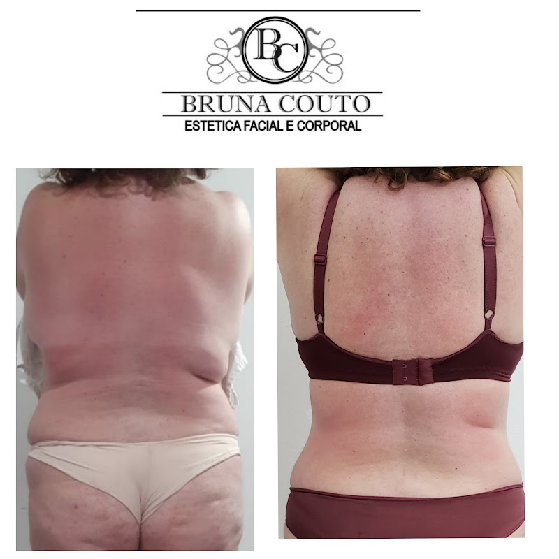 Esteticista Bruna Couto Campinas - Day Spa in Campinas