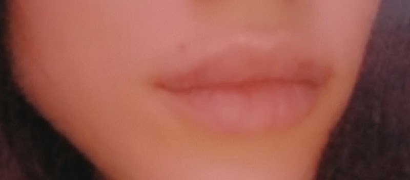 Extravagant Radiance Wareham photo