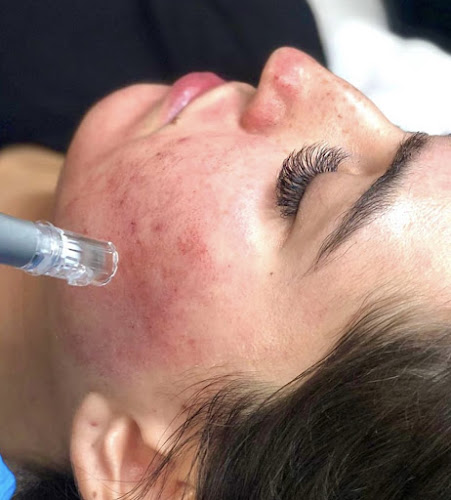 Face Halo Skincare and Aesthetics Belize City