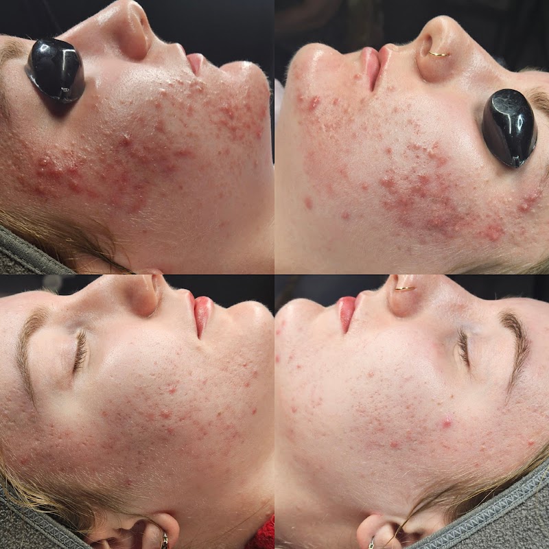 FACE It Skincare Therapy Buffalo - Day Spa in Buffalo