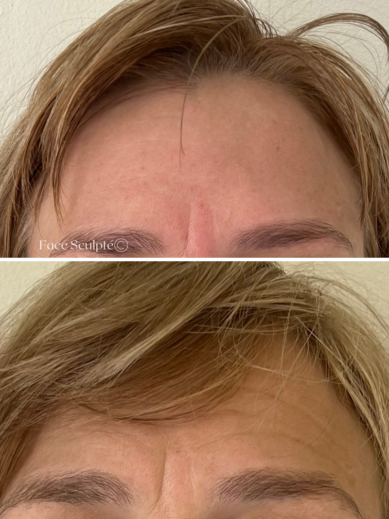 Face Sculpte Sydney - Day Spa in Sydney