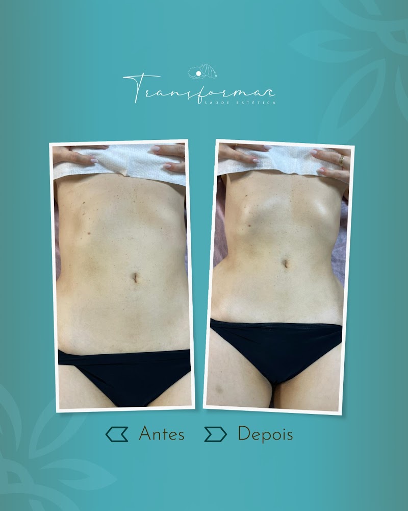 Fah Tratamentos Estéticos e Terapeuticos Pontal do Paraná - Day Spa in Pontal do Paraná