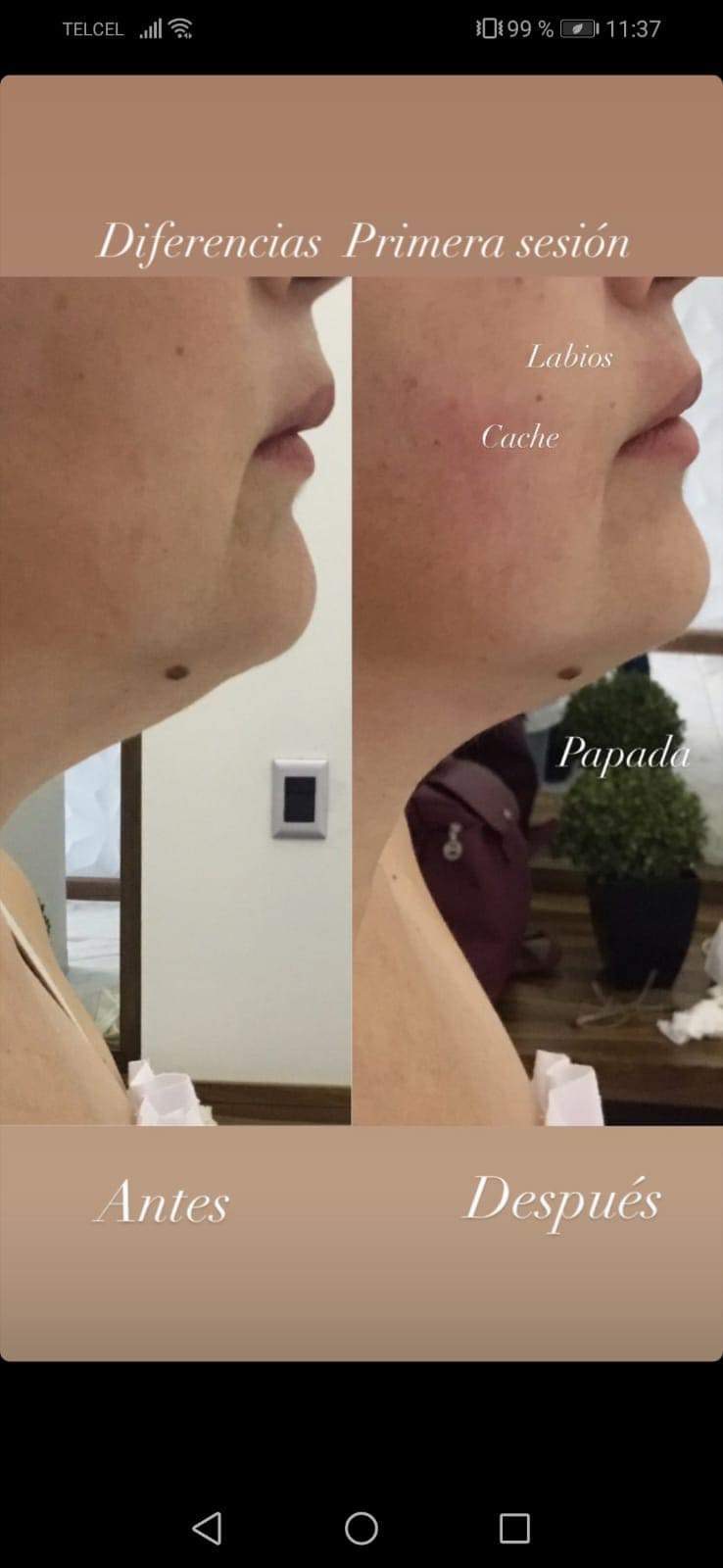 Ferco Spa Hermosillo photo