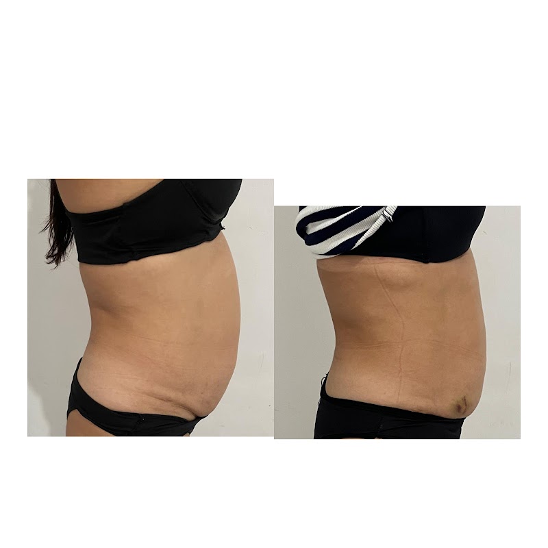 Fisio e Estetica Apuiarés - Day Spa in Apuiarés