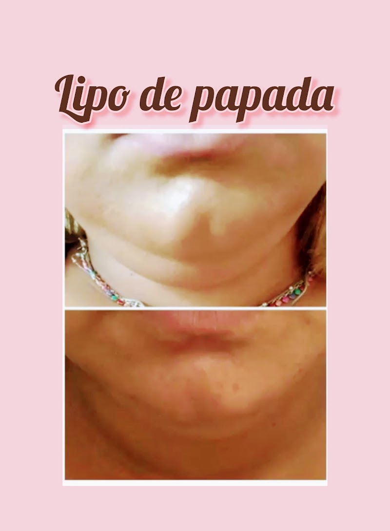 Fisioterapia Dermato-funcional e Estética Michelle Baraldi Fadel Conchal - Day Spa in Conchal