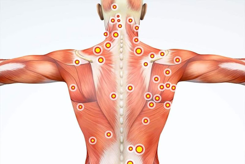 Fix and Heal Remedial Massage and Dry Needling Clinic Sunshine Coast - Medical Spa in Sunshine Coast